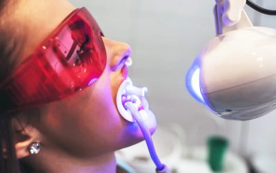 Laser Teeth Whitening: Is It Safe?