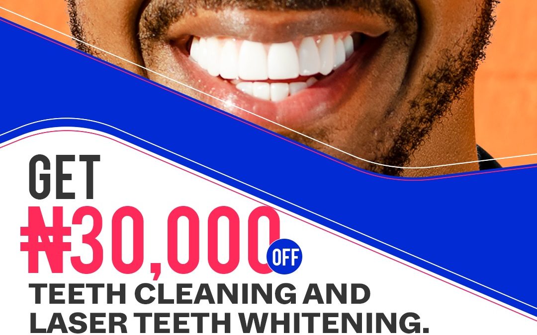 New Offer – 30k Discount!