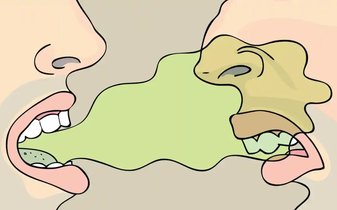Halitosis (Bad Breath): Causes, Treatment, and Prevention