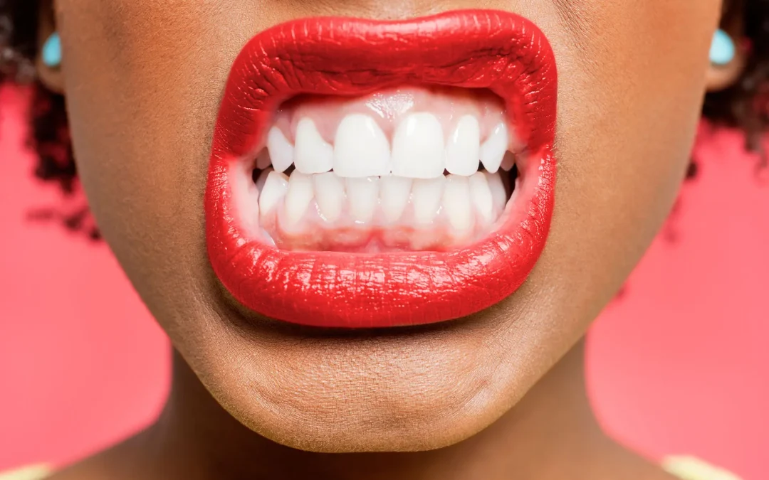 Understanding Bruxism: Causes, Effects, Age and Treatments